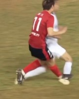 肿胀明显！博主晒三镇球员王毅脚踝被踩踏赛后情况